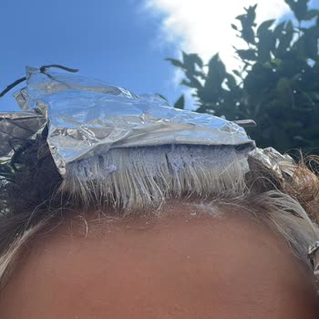 Saç Rengim Beyaza Döndü, Yıpranma Ve İlgisizliğe Rağmen Ücret İadesi İstiyorum