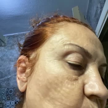 L'uva Aesthetics'te Yapılan İşlem Mağduriyet Yarattı!