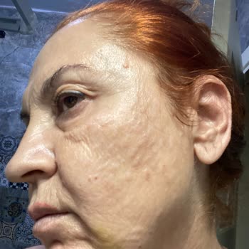 L'uva Aesthetics'te Yapılan İşlem Mağduriyet Yarattı!