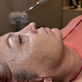 L'uva Aesthetics'te Yapılan İşlem Mağduriyet Yarattı!