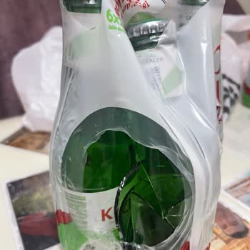 Kırık Soda Şişeleri Nedeniyle Eşim Elini Kesti Çözüm Sunulmadı