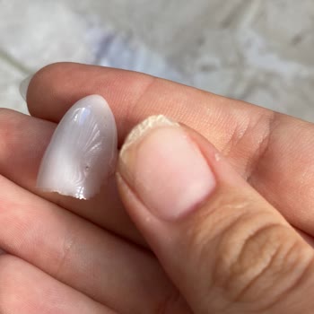 Protez Tırnaklar Kısa Sürede Döküldü, Sorun Çözülmedi