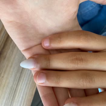 Protez Tırnaklar Kısa Sürede Döküldü, Sorun Çözülmedi