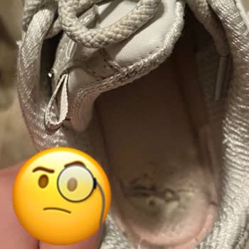 Skechers Kısa Sürede Deforme Olan Ayakkabıya Ret Cevabı Ve Güvenilmez İnceleme Süreci