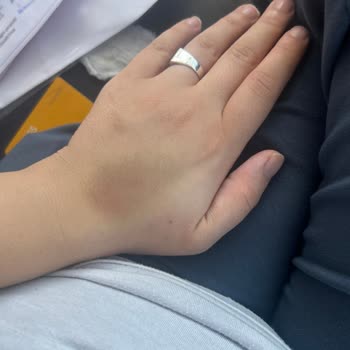 Acil Serviste Yanlış Serum Uygulaması Ve Dikkatsiz Sağlık Personeli Mağduriyeti