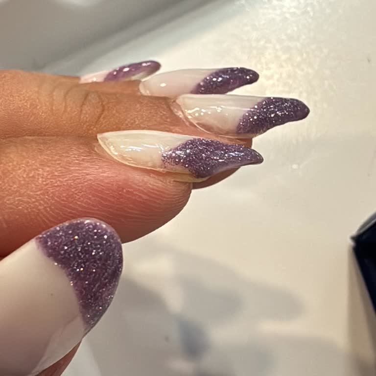 Kötü Yapılan Protez Tırnak İşlemi İçin Yeniden Ücret Talep Edilmesi