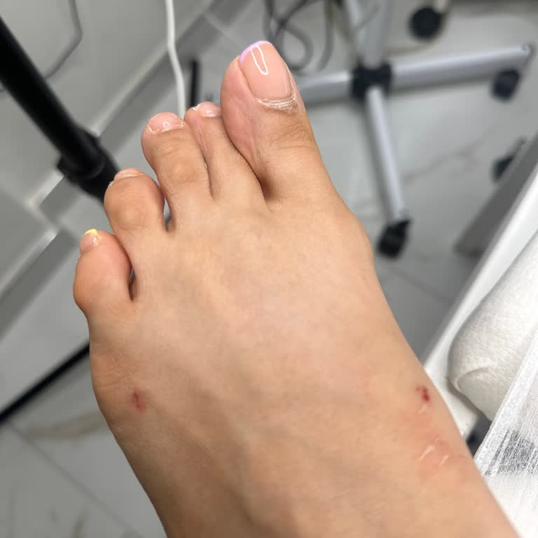 Kısa Sürede Ayağımı Yaralayan Terlik İçin Stradivarius'tan Çözüm Bekliyorum