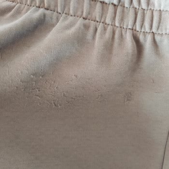 Adidas Mağazasından Alınan Eşofmanın Hızla Deforme Olması Ve İlgisiz Müşteri Hizmeti