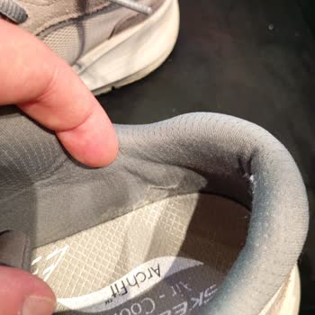 Skechers Ayakkabıda 6 Ayda Çatlama Ve Yırtılma Garanti Kapsamı Reddedildi