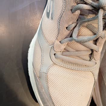 Skechers Ayakkabıda 6 Ayda Çatlama Ve Yırtılma Garanti Kapsamı Reddedildi