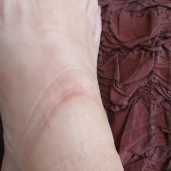 Kısa Sürede Ret: FLO’dan Aldığım Adidas Ayakkabı Ayağımı Yaraladı, Değişim Talebim Reddedildi