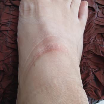 Kısa Sürede Ret: FLO’dan Aldığım Adidas Ayakkabı Ayağımı Yaraladı, Değişim Talebim Reddedildi