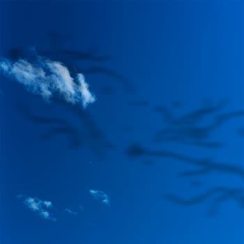 Lasik Ameliyatı Sonrası Kalıcı Görme Sorunları Ve Yetersiz Bilgilendirme Yaşadım