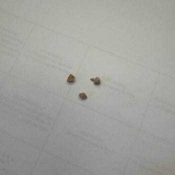 Yemekte Taş Çıktı, Müşteri Hizmetleri Yardımcı Olmadı