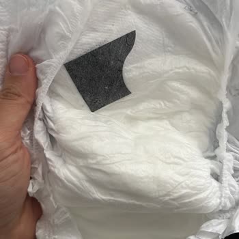 Bebek Bezinde Yabancı Madde Ve Sağlık Riski Endişesi