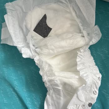 Bebek Bezinde Yabancı Madde Ve Sağlık Riski Endişesi