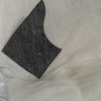 Bebek Bezinde Yabancı Madde Ve Sağlık Riski Endişesi