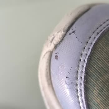 2 Ayda Yıpranan Ayakkabıya Red Cevabı: Skechers ve N11’den Çözüm Bekliyorum