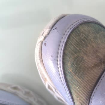 2 Ayda Yıpranan Ayakkabıya Red Cevabı: Skechers ve N11’den Çözüm Bekliyorum