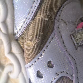 2 Ayda Yıpranan Ayakkabıya Red Cevabı: Skechers ve N11’den Çözüm Bekliyorum