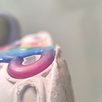 2 Ayda Yıpranan Ayakkabıya Red Cevabı: Skechers ve N11’den Çözüm Bekliyorum