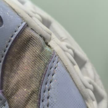 2 Ayda Yıpranan Ayakkabıya Red Cevabı: Skechers ve N11’den Çözüm Bekliyorum