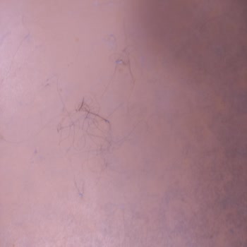 Semerkand Kültür Merkezi Havuzunda Temizlik, Hijyen Ve Üyelik İptali Sorunları