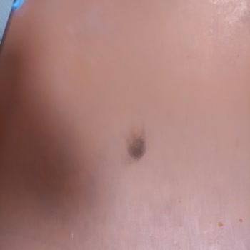 Semerkand Kültür Merkezi Havuzunda Temizlik, Hijyen Ve Üyelik İptali Sorunları