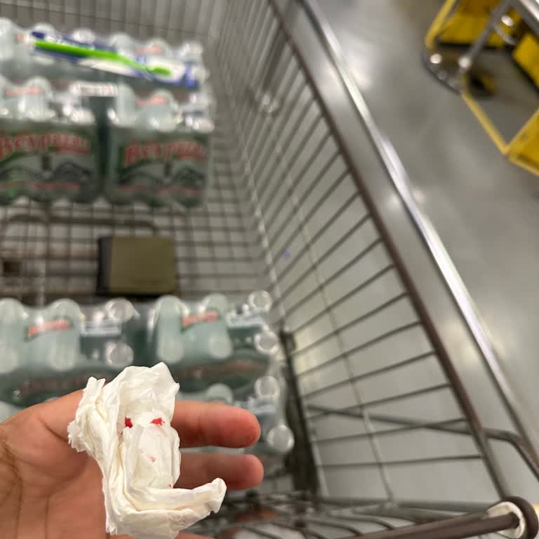 Metro Grossmarket Adana Kırık Soda Şişesi Nedeniyle Elimi Kestim Çalışanlar İlgisizdi