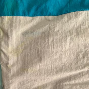 Yıkama Talimatına Uymama Rağmen Renk Atan Trençkot Ve Müşteri Hizmetlerinde Destek Eksikliği