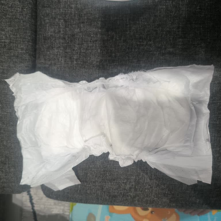 Bebek Bezinde Eksik Cırt Cırtlar Kullanımda Sorun Yaşattı