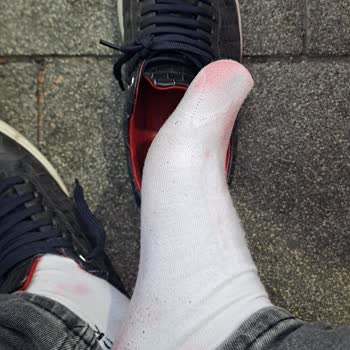 Hotiç Ayakkabı Her Giyişimde Yara Ve Boya Problemi Yaşatıyor