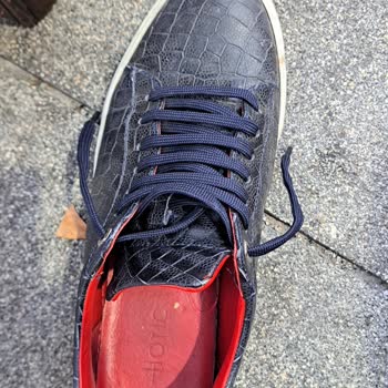 Hotiç Ayakkabı Her Giyişimde Yara Ve Boya Problemi Yaşatıyor