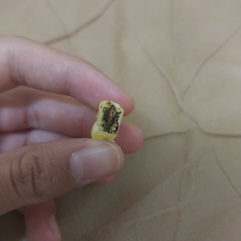 Aldığım Eti Gong Ürününün Üzerinde Siyahlık Şoku!