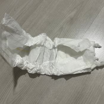 Sleepy Natural Bebek Bezinde Kalite Sorunları Ve Eksik Parçalar