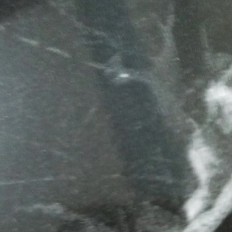 Hesabımın Kapatılması İçin Defalarca Talepte Bulundum Sonuç Alamadım