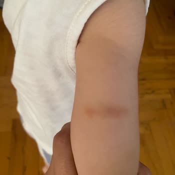 Anaokulunda Güvenlik Ve İlgisizlik Nedeniyle Çocuğumun Sağlığı Tehlikede