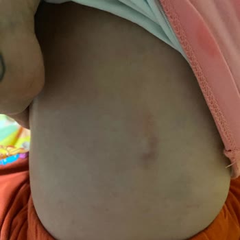 Anaokulunda Güvenlik Ve İlgisizlik Nedeniyle Çocuğumun Sağlığı Tehlikede