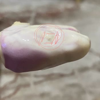 Aldığım Dondurmanın İçinden Kıl Çıktı, Hijyen Konusunda Mağdur Oldum