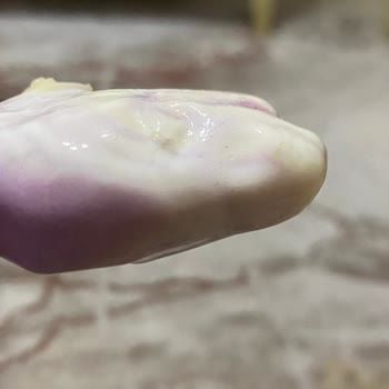 Aldığım Dondurmanın İçinden Kıl Çıktı, Hijyen Konusunda Mağdur Oldum