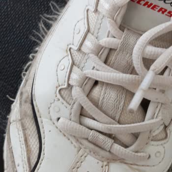 Kısa Sürede Deforme Olan Ayakkabı İçin Garanti Kapsamında Değişim Talebi