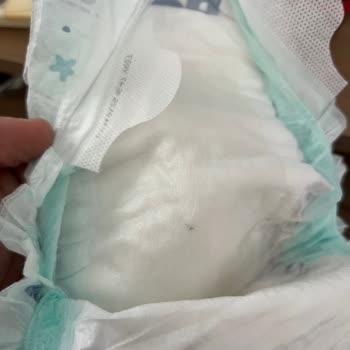 Bebek Bezinde İğne Benzeri Cisim Buldum, Güvenlik Endişesi Yaşıyorum