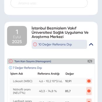 Nirvana Dolce Vita Otelde Yaşadığım Besin Zehirlenmesi Tatilimi Kabusa Çevirdi