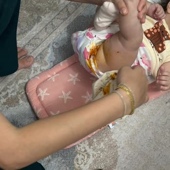 Molfix Premium Bebek Bezi Sürekli Sızdırıyor Ve Müşteri Hizmetleri Çözüm Sunmuyor