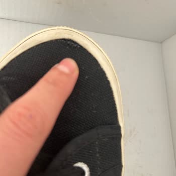 Superga Siparişimde Beklenmedik Kalite Sorunu Ve Ulaşılmaz Müşteri Hizmeti