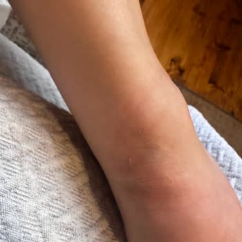 Derimod İlk Kullanımda Ciddi Rahatsızlık ve Yetersiz Müşteri Hizmeti