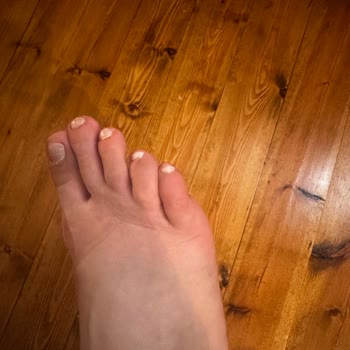 Derimod İlk Kullanımda Ciddi Rahatsızlık ve Yetersiz Müşteri Hizmeti