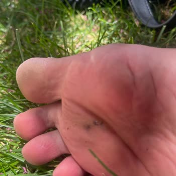 Yeni Aldığım Sandalet Ayağımı Yaraladı Mağaza Çözüm Sunmadı