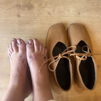 Yeni Alınan Ayakkabının Boyası Ayaklarıma Geçti Ve İç Kısmı Dökülmeye Başladı