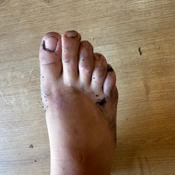 Yeni Alınan Ayakkabının Boyası Ayaklarıma Geçti Ve İç Kısmı Dökülmeye Başladı